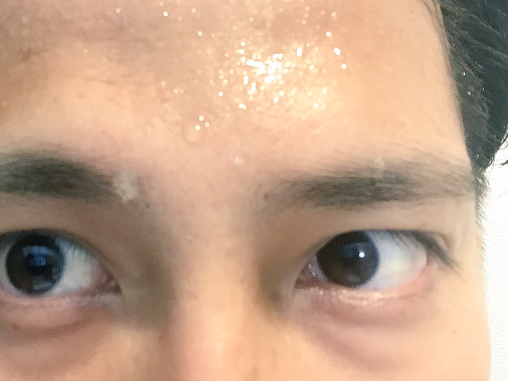 おじま紘平 東京都議会議員 練馬区 Twitter પર 梅雨明けとの報 本格的に夏ですね 私 重度の多汗 症のため これからの時期は周りに引かれるくらいの汗だくで各所に現れます ご容赦ください 良い対処法などもお待ちしております Https T Co Ffooogky4r