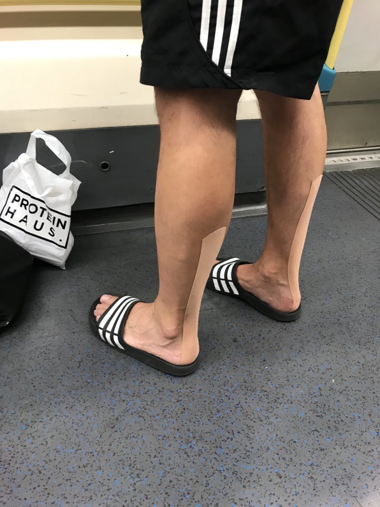 petewebfitness's tweet photo. It seems I have to lay off the skipping practice for a while ☹️😩Zoe was amazing @NewBodyOsteo #ptproblems #plantarfasciitis #needtoputmyfeetup #proteinhaus #fitness #health #trainingreenwich #personaltrainer  #PT #gym #workout #itrainwithpete https://t.co/BrXUIOlBSU