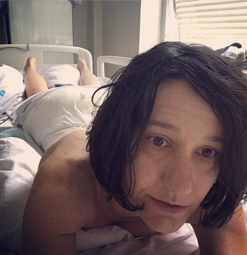carolaperez's tweet image. La de hoy, la que más he sufrido hasta ahora. El dolor inhumano y el despertar de la anestesia una pesadilla. Gracias por todas las llamadas y mensajes, sois amores! 💕 13 superada!! ✌🏻

#Postoperatorio #LaPaz #EspaldasRotas #Frankeenweenie