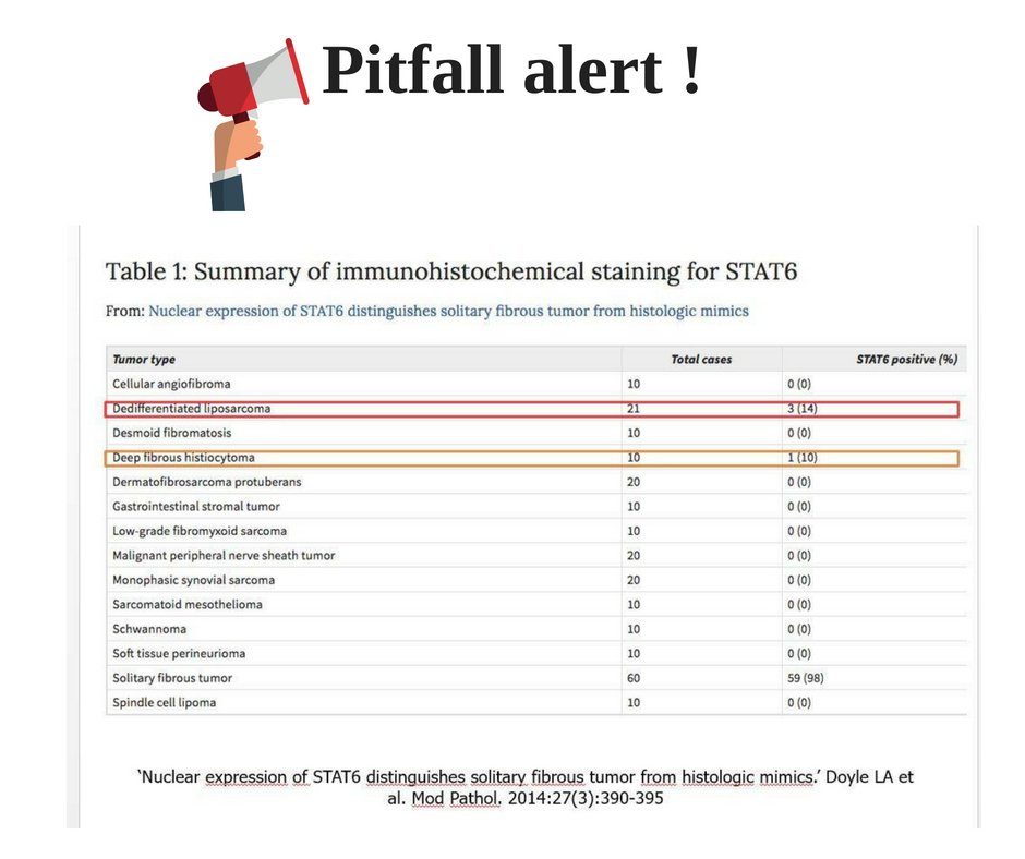PITFALL ALERT ! Not every case with CD34 and Stat6 positive will be a Solitary fibrous tumor!
Recurrent back tumor. Final Dx: Dedifferentiated Liposarcomas (With a Solitary Fibrous Tumor-like Morphology) #Bstpath #pathology