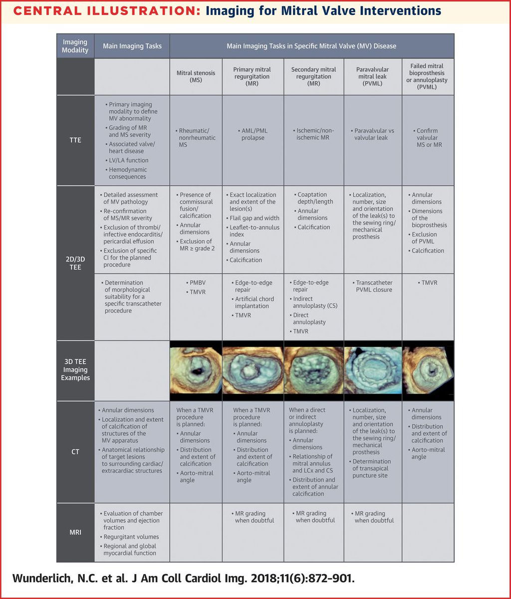 JACCJournals's tweet photo. The role of #multimodality mitral valve imaging continues to evolve. How do you use imaging to inform mitral interventions? https://t.co/thApjD41Ex #JACCIMG #structuralheartdisease #tmvr #pmbv #pvml https://t.co/Io5x9GqgpP