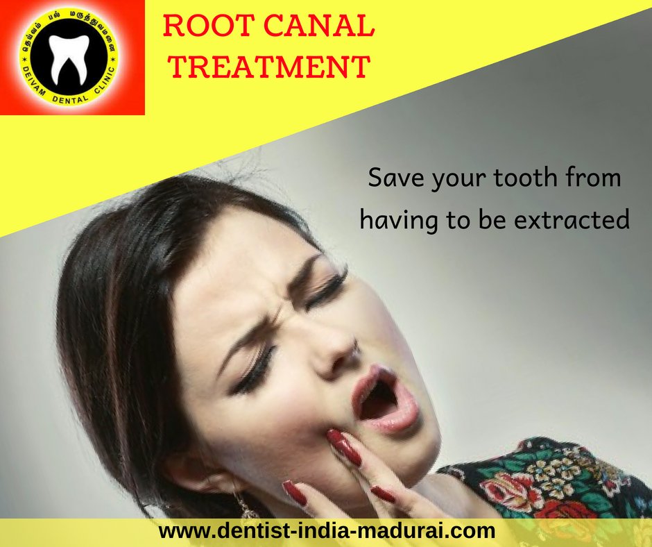 Relieve your toothache through Root Canal Treatment...!
Know the benefits of undergoing a Root Canal Treatment
For more details: dentist-india-madurai.com/root-canal-tre…
Make an appointment now: dentist-india-madurai.com/book-appointme…
#Dental_Treatment #Tooth_Pain #Root_Canal_Treatment
#Madurai #Tamilnadu