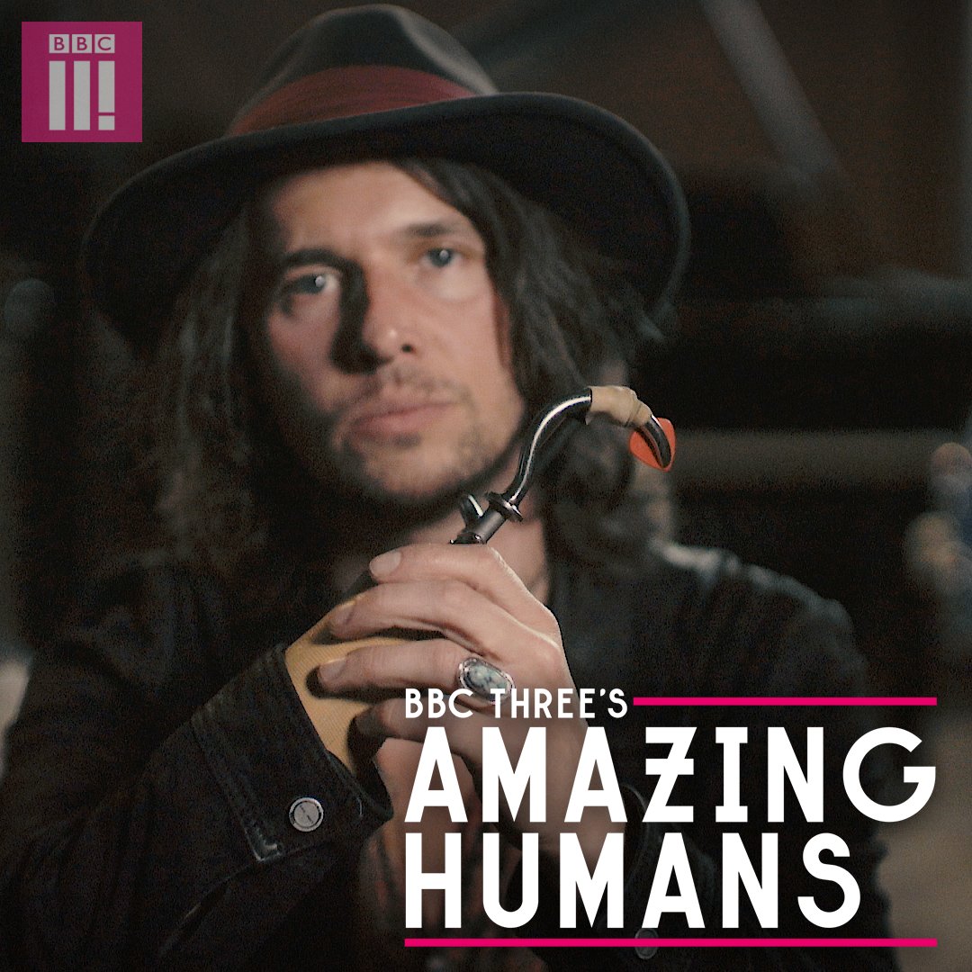 BBC on Twitter "🎸 This amazing human learnt to play guitar with a hook. https//t.co/GaTQ0FDpF4"