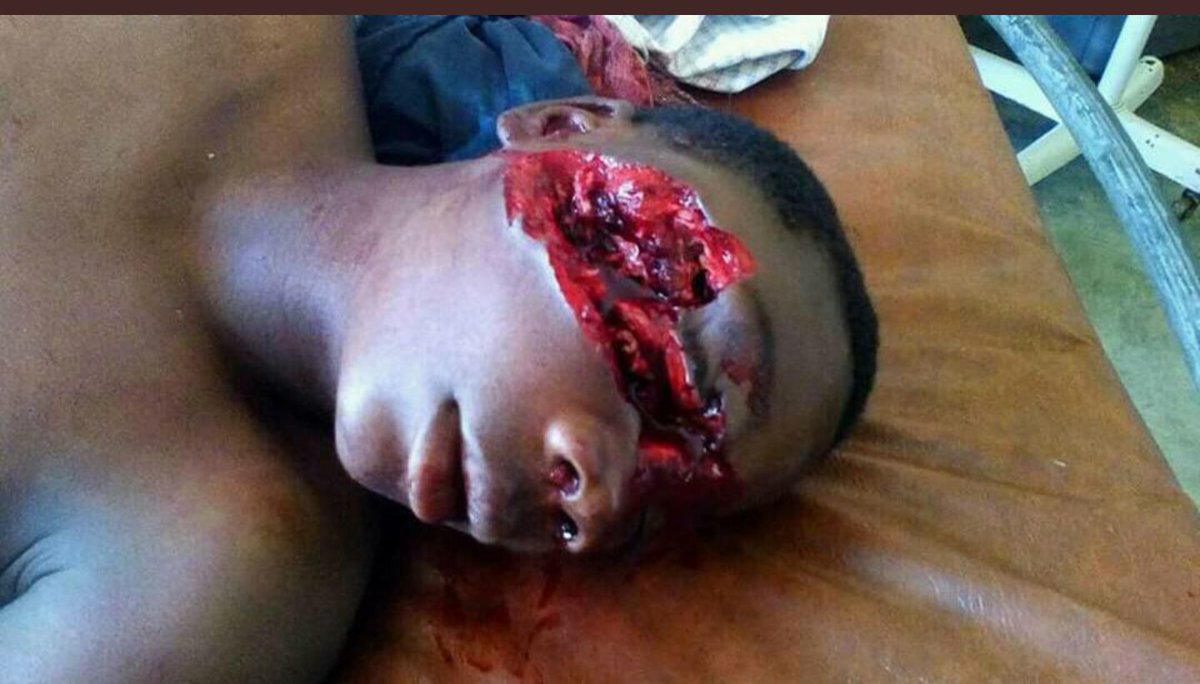 FNFORSC2's tweet photo. #GenocideInSouthernCameroons
#FreeAllArrested
#RecognizeAmbazonia
#UpholdResolution1908
#DeployPeaceKeepers
Women and children of Southern Cameroons are no longer safe in the hand of Cameroon terrorist military
@HouseForeign @maddow @BBC @hrw @PutinRF_Eng @Sverigesriksdag https://t.co/0YerZvACTa