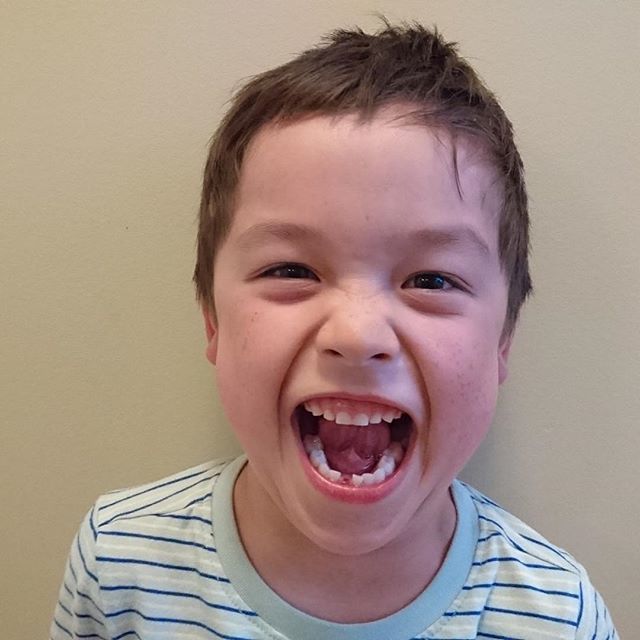 lisakeen's tweet photo. Someone lost his first tooth tonight. .
.
.
.
.
#lostfirsttooth
#toothfairyiscoming
#fiveyearsold
#mybabyisgrowingup
#bodensworld
#oakvillemomblogger
#momblogger https://t.co/Ug0D2do2nG https://t.co/bqFlj5l5sI