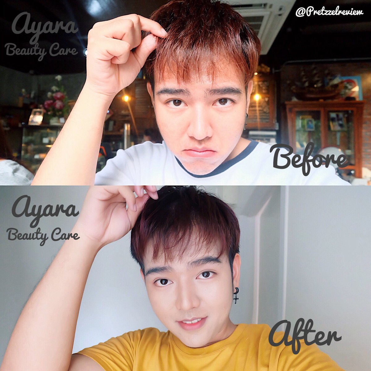 PretzzelReview's tweet photo. ใครผมเสีย จากการย้อมผมกัดสีผมบ่อยๆแบบเรา อยากให้ลองทรีทเม้นท์บำรุงผมของ Ayara ตอนแรกเห็นแบบคนรีวิวเยอะมาก คิดว่าคงเป็นแค่กระแส ที่ไหนได้ คือ ใช้ดีจริง กลิ่นหอมติดผมไปประมาณ 3 วันเลย ผมนุ่มขึ้นเยอะเลยหลังจากที่ใช้ ดูจากรูปได้ ผมดูสุขภาพดีไม่แตกปลาย และชี้ฟูเหมือนเก่า 
#ถูกและดี https://t.co/DX83b5OdRw