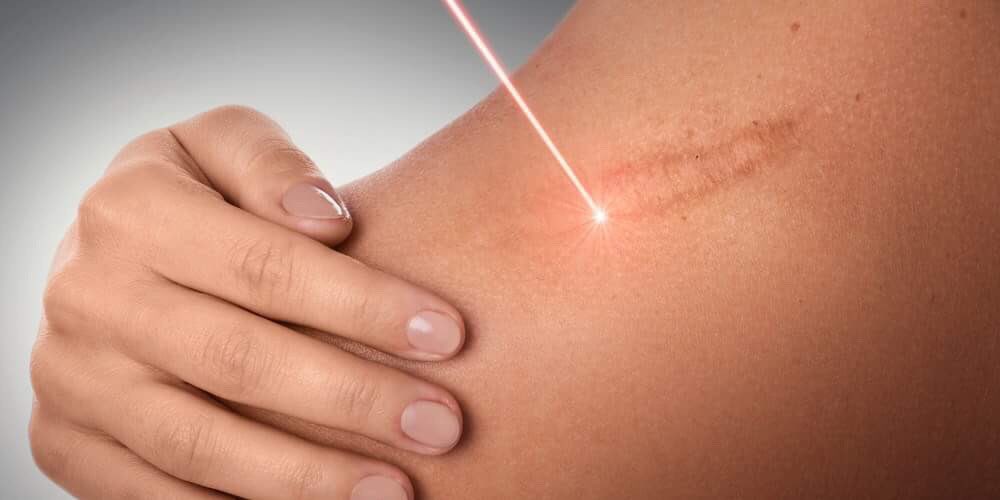 DrAshishDutta's tweet photo. We were the first clinic outside Australia to undertake #ReCell, which involves a very fine #SkinGraft being taken by myself, from which the #Epidermal junction is extracted for regeneration transferal making it perfect for #DeepScars.
https://t.co/ctL65sq2Xh https://t.co/u3yblfwOpV
