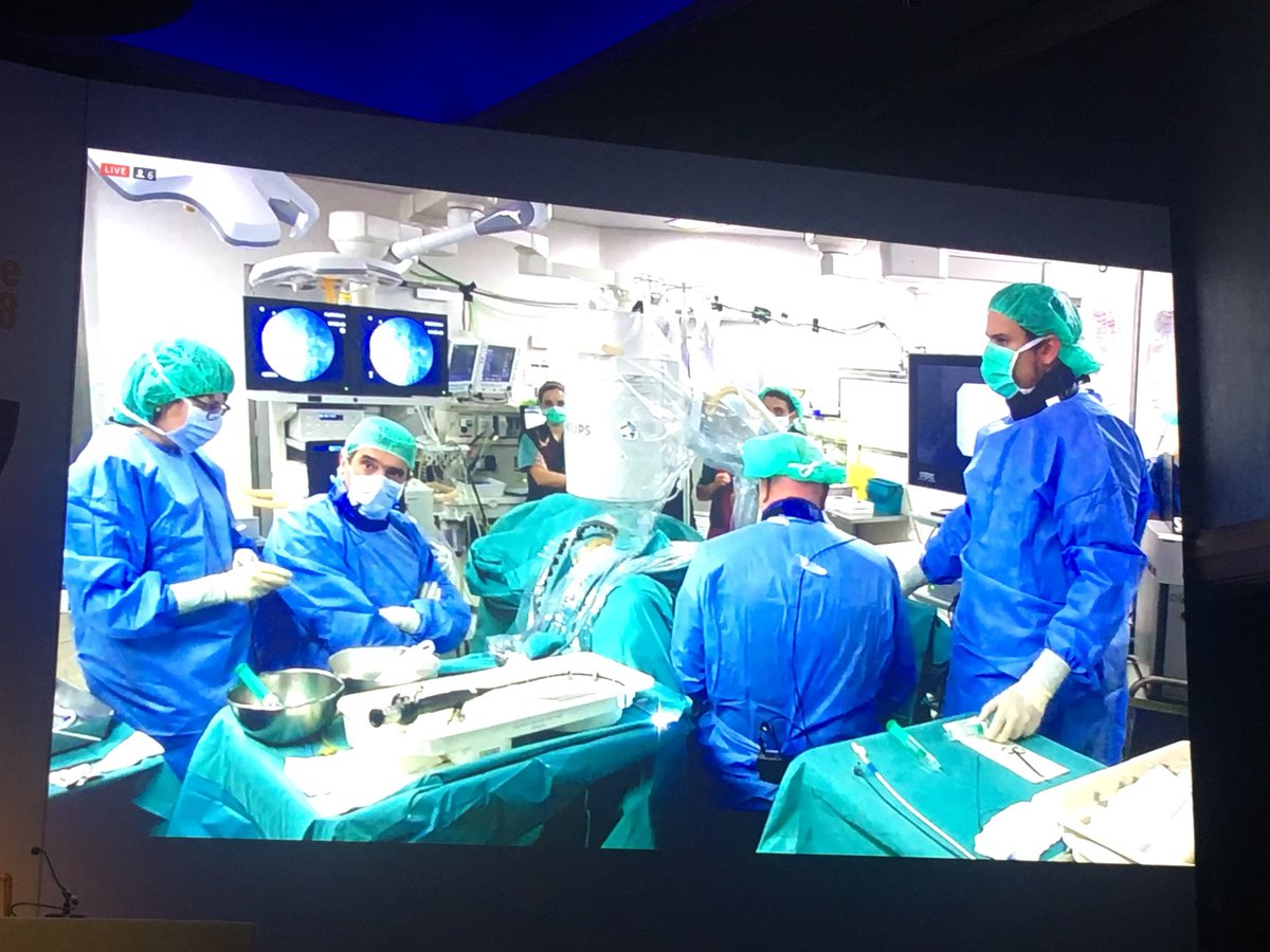 Perfect ECIRS surgery for renal stone performed by @scoffonecesare Cecilia Cracco and Palle Osler at #CIE18 we are just over a month now to have it as a professor in our course in Leon!!! @urobraulio @SIU_urology @smumexico @alexfige86 @EndouroPaco @Endouro2016