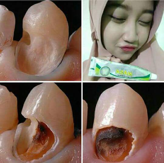 BOSONLINE1's tweet photo. Ready banyak Lagii yak PGN nya 😉😉
yuks siapa xg mau order 😉😉
cuma 20.000 bisa mendapatkan gigi xg bersih sehat bisa juga buat sembuhin sakit gigi 😘😘

bisa konsultasi/order
WA 082243504015 https://t.co/cTRWp73Cee