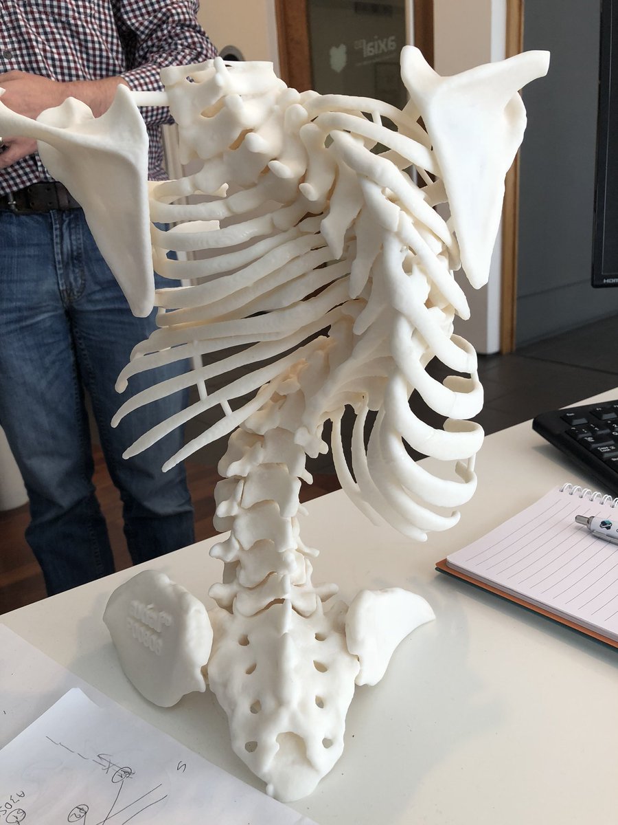 axial3Dan's tweet photo. #surgeons always ask us how big we can #3Dprint. With @axial_3D ‘s awesome team there are no restrictions. Full #spine #scoliosis case uploaded to @axial_3D software and dispatched in 48 hours #3DPrinting for #orthopaedic #planning #form2 https://t.co/qz7TWsv7lS
