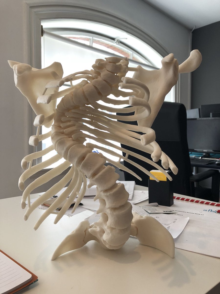 axial3Dan's tweet photo. #surgeons always ask us how big we can #3Dprint. With @axial_3D ‘s awesome team there are no restrictions. Full #spine #scoliosis case uploaded to @axial_3D software and dispatched in 48 hours #3DPrinting for #orthopaedic #planning #form2 https://t.co/qz7TWsv7lS