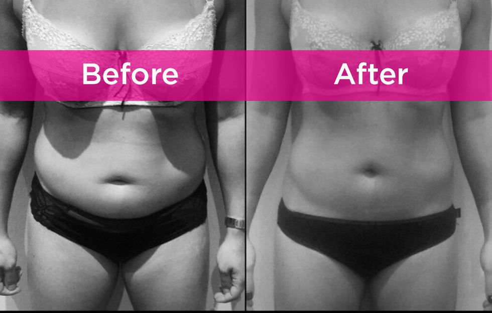 DrCMcAlpin's tweet image. Lose Significant Inches With SculpSure        
(ow.ly/N5IT30jMAYf)

#fatcells #exercisefail #southerncali