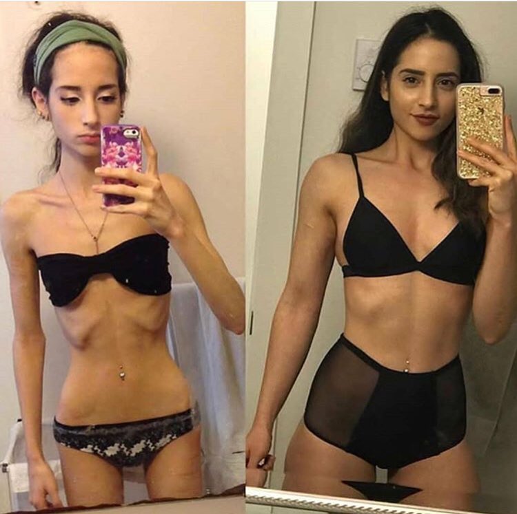 Kinaco Di Twitter ガリガリに痩せ細った身体より 適度に運動して食事を改善して 綺麗に引き締めた身体のが何倍も綺麗で魅力がある 細さだけが全てじゃない Kinaco Di Twitter ガリガリに痩せ細った身体より 適度に運動して食事を改善して 綺麗に引き締めた身体のが何倍も綺麗で魅力がある 細さだけが全てじゃない