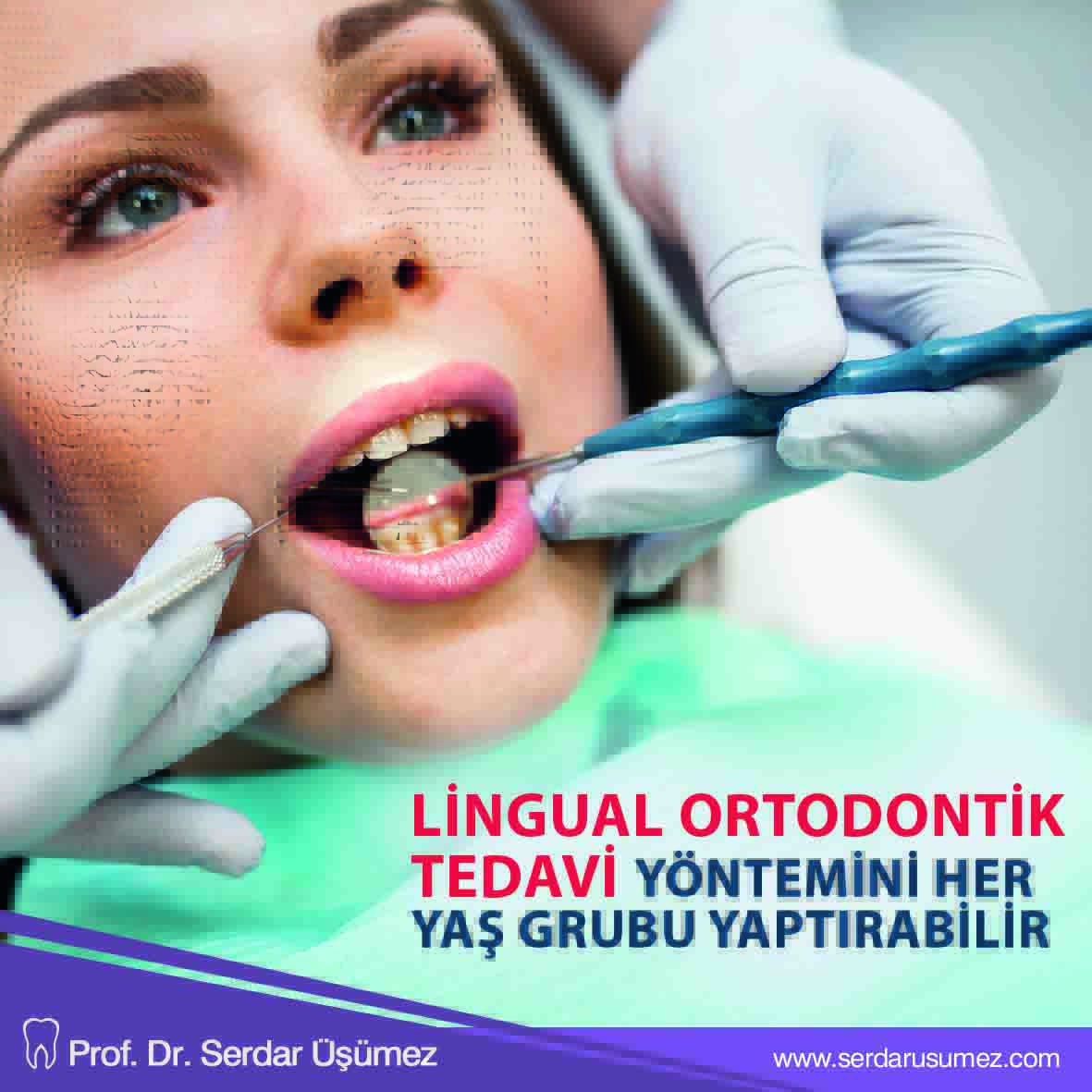 Lingual ortodontik tedavi yöntemini kadın, erkek, genç, yaşlı, çocuk her yaş grubu yaptırabilir. Tedavi hastanın diş yapısına ve varsa özel taleplerine göre planlanır. 
.
.
#serdarusumez #saglık #dis #dissaglıgı #health #teethhealth #ortodontik #Invisalign #healthlife #ortodonti