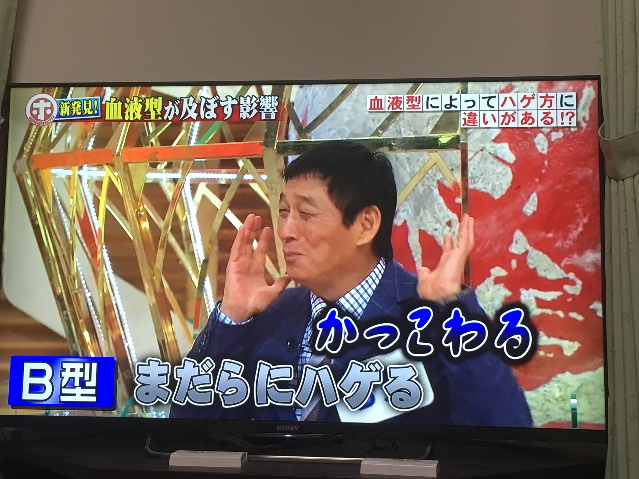 見る専に変更 血液型のハゲ方の違い A型 前からハゲが進行 B型 まだらにハゲる Ab型 ハゲにくい O型 最終的にはツルンと行く らしい 先生の言い方に笑ってしまったw A型 B型 O型 Ab型 血液型 血液型診断 ホンマでっかtv フジテレビ T 見る専に変更 血液型のハゲ方の違い A型 前からハゲが進行 B型 まだらにハゲる Ab型 ハゲにくい O型 最終的にはツルンと行く らしい 先生の言い方に笑ってしまったw A型 B型 O型 Ab型 血液型 血液型診断 ホンマでっかtv フジテレビ T