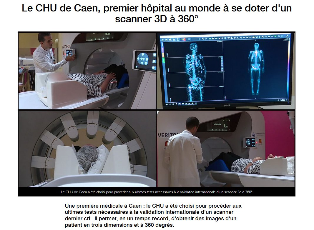 Caenlamer's tweet photo. 🔴1ère mondiale : le @CHU_Caen 1er hôpital 🏥au monde à se doter d'un scanner 3D à 360° ! Exceptionnel ! #Caen #Caenlamer Via @F3bnormandie : https://t.co/EtI1yo3GMe #scanner #santé #innovation #CHU https://t.co/9POZCWGSrc