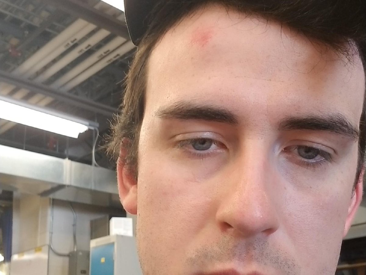 capitalsqvbl's tweet photo. You know that sound of a baseball when it hits the inside of a dugout? Apparently it sounds the same when it goes off someone's skull inside the dugout. https://t.co/CqunCa3hf3