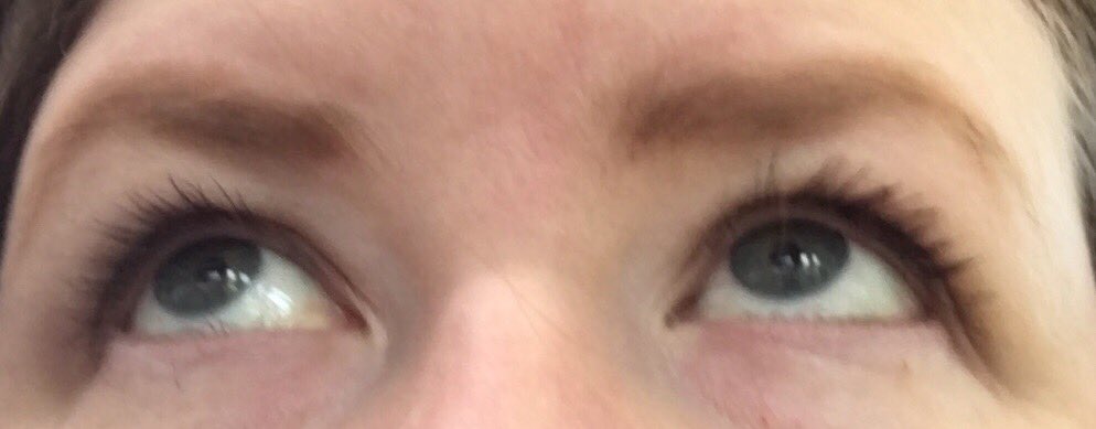 CharisseEaster's tweet photo. While colouring in my sparse eyebrows this morning my 8 year old says “Why do women make their eyebrows look angry” LOL #thyroideyebrows #hypothyroid #angryeyes https://t.co/63fkmM6jv9