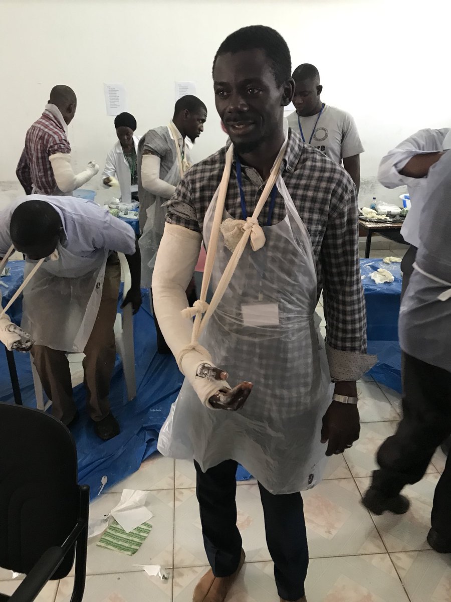 DrKebsun's tweet image. Day 2 of @TheAOAlliance non-operative fracture management course at EFSTH. More gun learning again today. Everyone got stuck in for the practicals