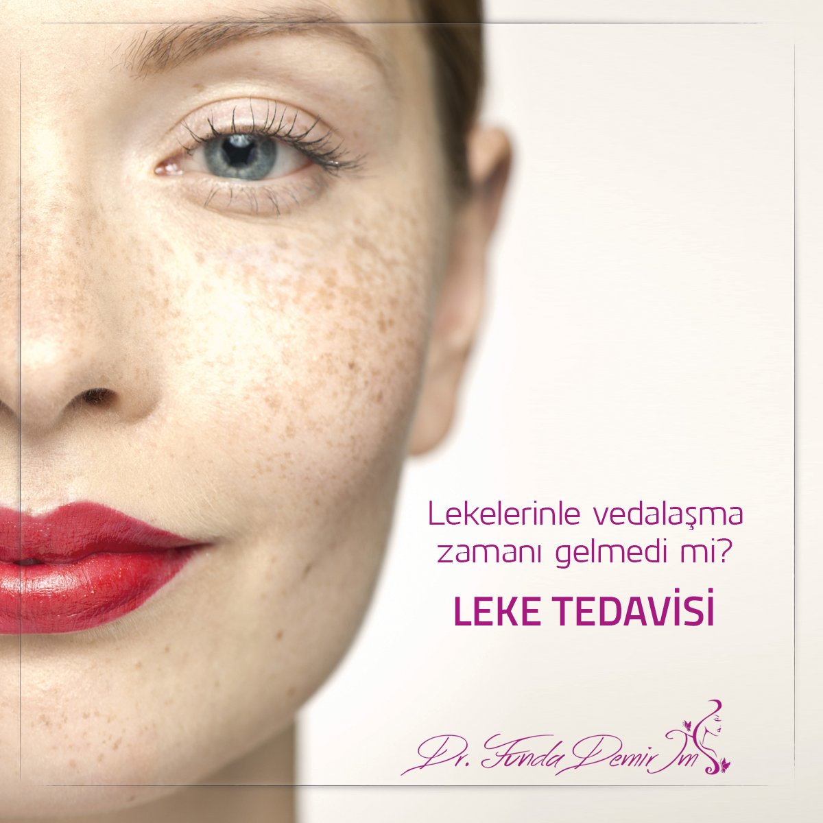 Lekelerinle vedalaşma zamanı gelmedi mi?
#leketedavisi #lazerleleketedavisi #güneşlekesi #güneşlekeleri #çiller #yaşlılıklekeleri #etbenleri #etbeni #doğumlekeleri #lazerlileketedavisi #tedavi #leketedavileri #cilt #estetik #medikalestetik #bakım #yöntem #doktor #DrFundaDemirİm