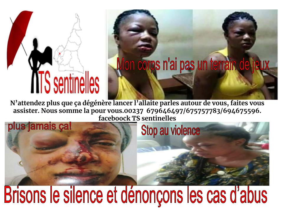 Expertsantes's tweet image. vaste campagne de lutte contre les violence faites aux femmes TS du 1 au 31 juillet 2018 dans tout le territoire @camerounais #violence #Cameroun #prevention @Ke_swa @alcondoms @alcondoms