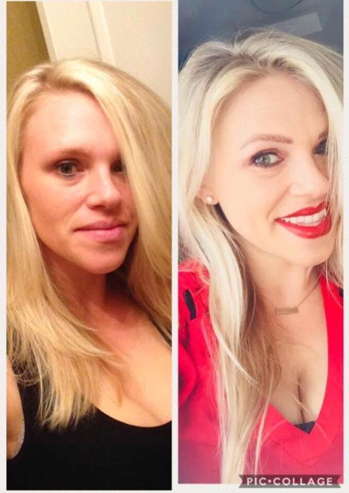 DamTheButterfly's tweet photo. Fellow Warriors who suffer from #ThyroidDiseaseHairLoss, we are happy to have found a toxin-free product that helps us with hair loss. Attached below in tweet #2 is a testimony from a Fellow #ThyroidDisease Warrior. 🦋 https://t.co/lYHrT4IrrW
