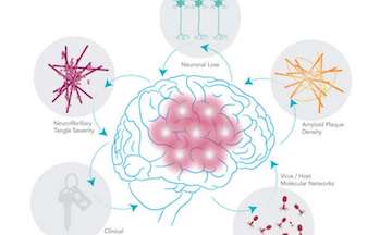 LetsFaceItCare's tweet photo. "New #Study Suggests #ViralConnection to #Alzheimer's #Disease"
https://t.co/uLV3h1f8nb
#LatestHealthCareNews https://t.co/4Gy0LuAKNj