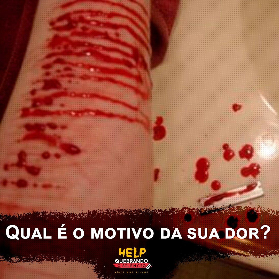 thaynaccrepaldi's tweet photo. Posso te ajudar .  
#BlocoCampinas #Help #NaoéFrescura #Naftali https://t.co/TaS0exc74a