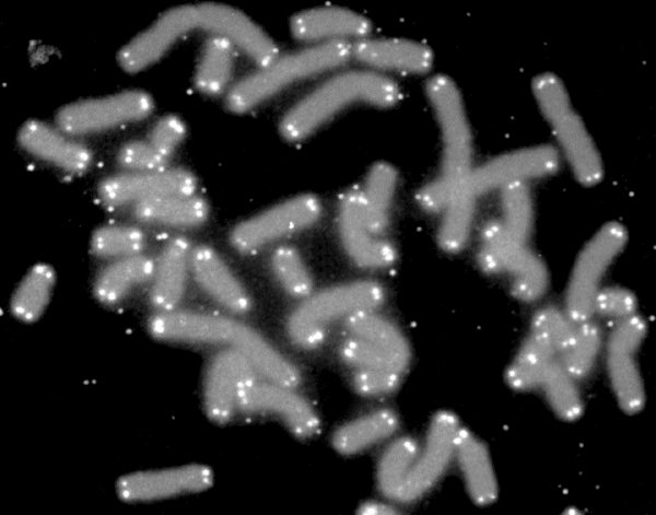 Telomeres are like shoelace caps on the ends of your chromosomes- a buffer zone, codes for nothing, keeps it from unwravelinglook, here’s yours, the little white spots on these human chromosomeshow do these things relate to our inevitable decline into death? here’s the deal