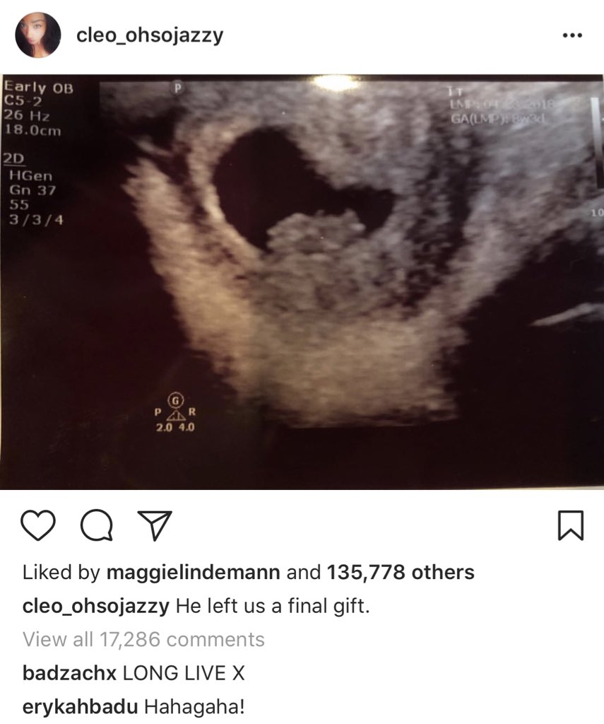 Pop Crave on X: XXXTentacions mother took to Instagram to reveal X had a  baby on the way. Its unclear who the childs mother is, but many are  speculating its his ex-girlfriend,