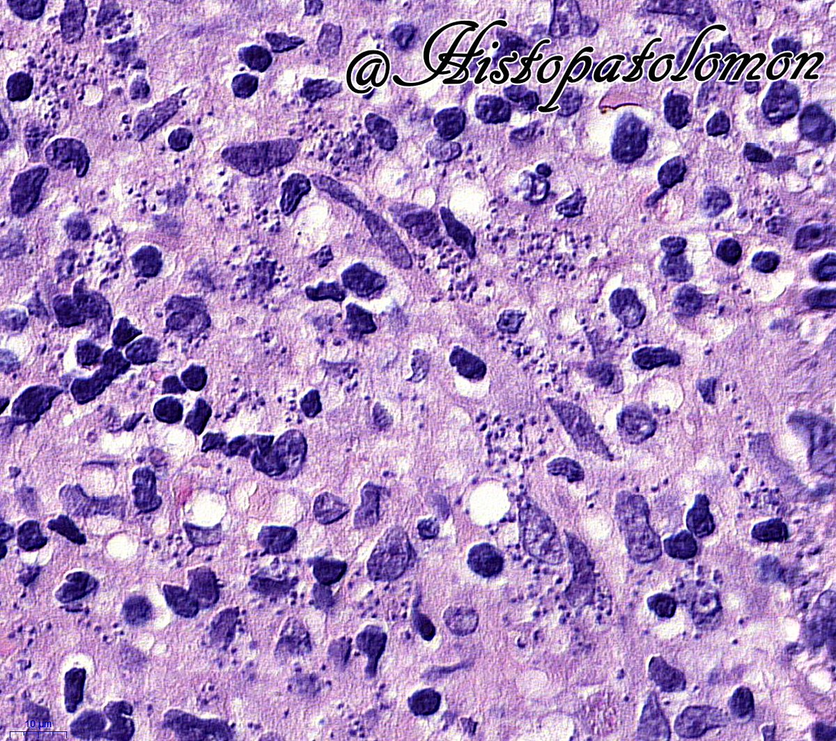 Histopatolomon's tweet photo. Leishmania minefield #Pathart #dermpath #Leishmania #bugpath https://t.co/TfR01MmhAY