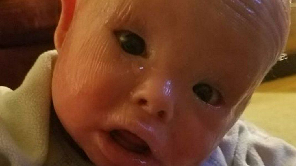 Mom bathes 1-year-old son with rare skin disorder in bleach to keep him alive on.11alive.com/2MJPTNk https://t.co/Jt9O62iN0I
