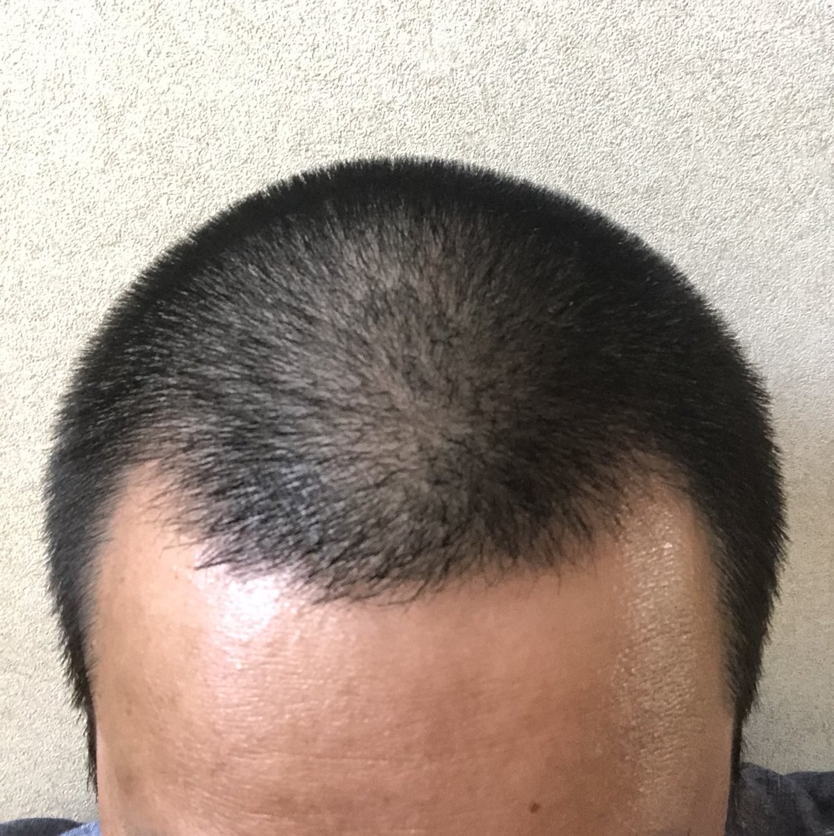 頭の形が綺麗なのは自慢 頭の形が綺麗なのは自慢