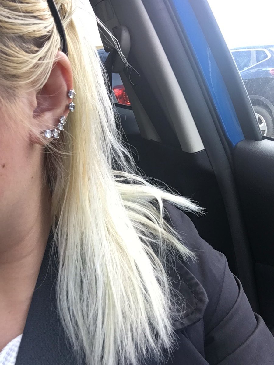 Vev On Twitter That S Really Painful With So Much Bleaching