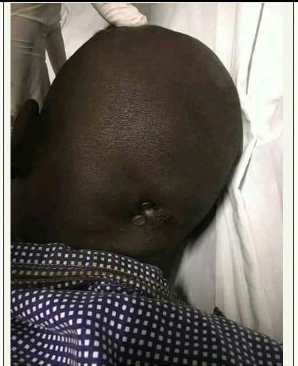 MaskoffPh's tweet photo. Stay away from other people's property.

This Kenyan got nailed with two 6"nails into his skull when caught in bed with another man's wife.

Talk about being drilled while drilling! 😂#maskoffph https://t.co/X8t4Th15Xc