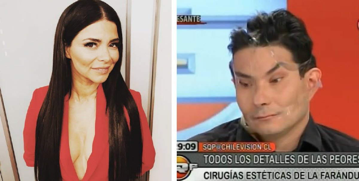 Publimetro No Twitter Que Se Hizo Antonella Rios En La Cara El Publico Y Las Redes Sociales Critican El Rostro De La Actriz Https T Co P9ahtuo8g7 Https T Co Q3ak5dvpzk