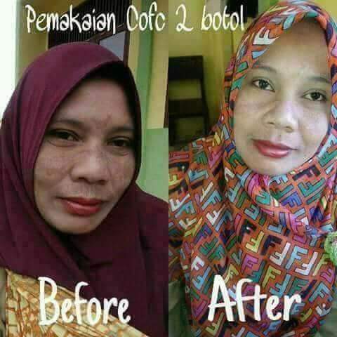 BOSONLINE1's tweet photo. Kini Uhkti Tidak Perlu Galau Lagi Gara-gara Jerawat, Flek Hitam Dan Kusam..Atasi Masalah Kulit Mu Dengan Perawatan Alami Ini Yang Murah, Aman Serta Mudah Di Lakukan Setiap Hari. Yukkk saat'a anda memnjakan kulitmu dengan collaskin facial cleanser 😍😍😍😍

Order 082243504015 https://t.co/n1te7QHxUJ