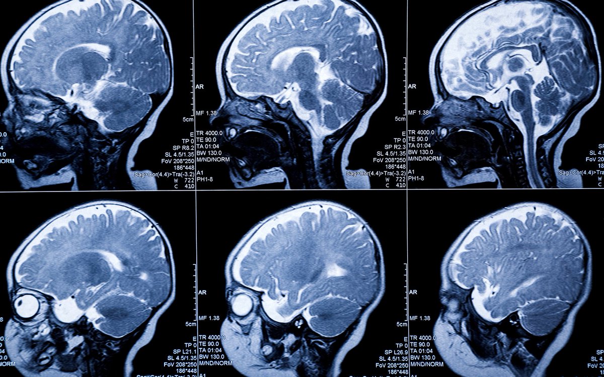 The Arizona chapter of Mothers Advocating Medical Marijuana for #Autism, is working hard to make their state the sixth to specifically allow autism patients to legally access whole plant cannabis, so long as they get the appropriate doctor recommendations. bit.ly/2IhhWQQ