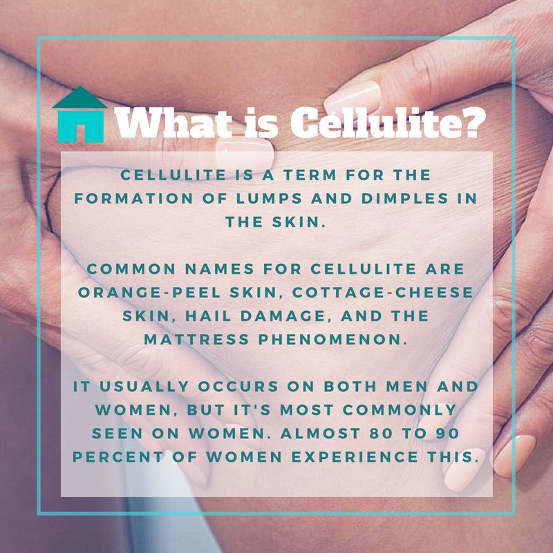 Skin House Beauty On Twitter Cellulite Is A Term For The