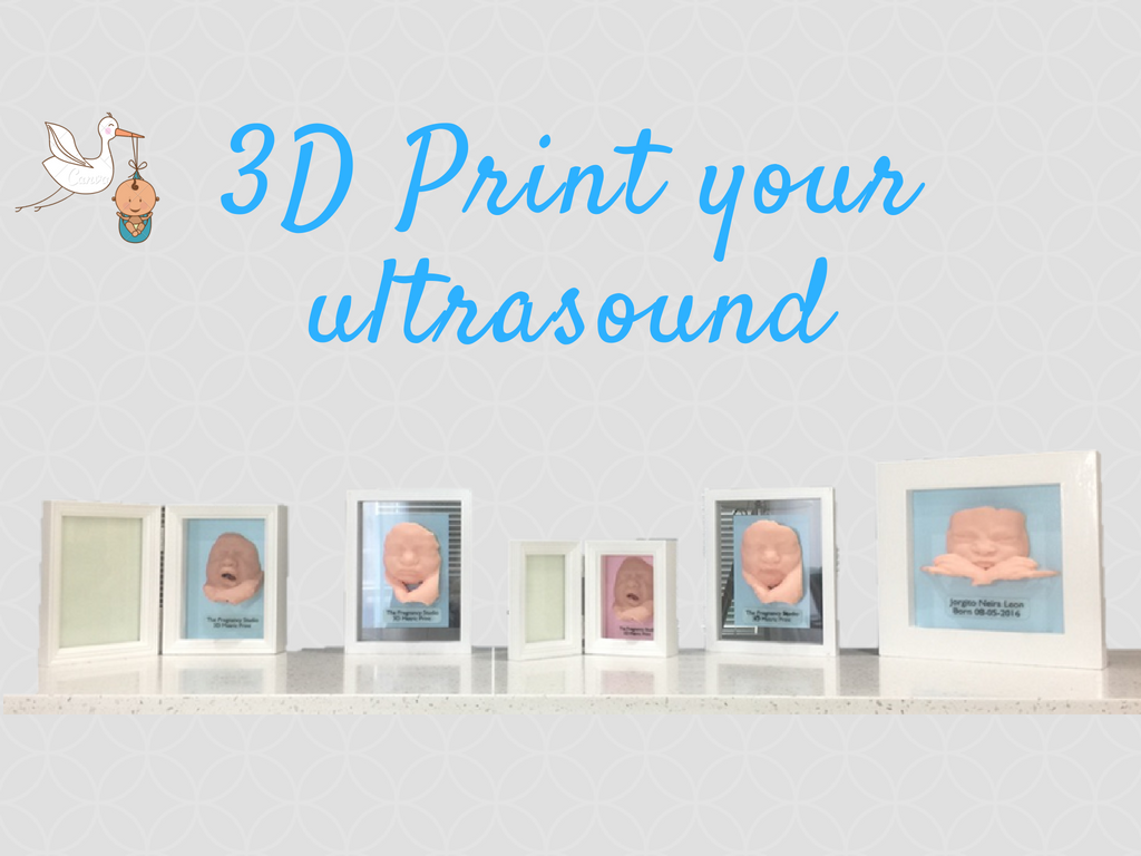 3dUSprint's tweet photo. 3D PRINT OF  @ULTRASOUNDS👶😍 https://t.co/PojM5s28oM