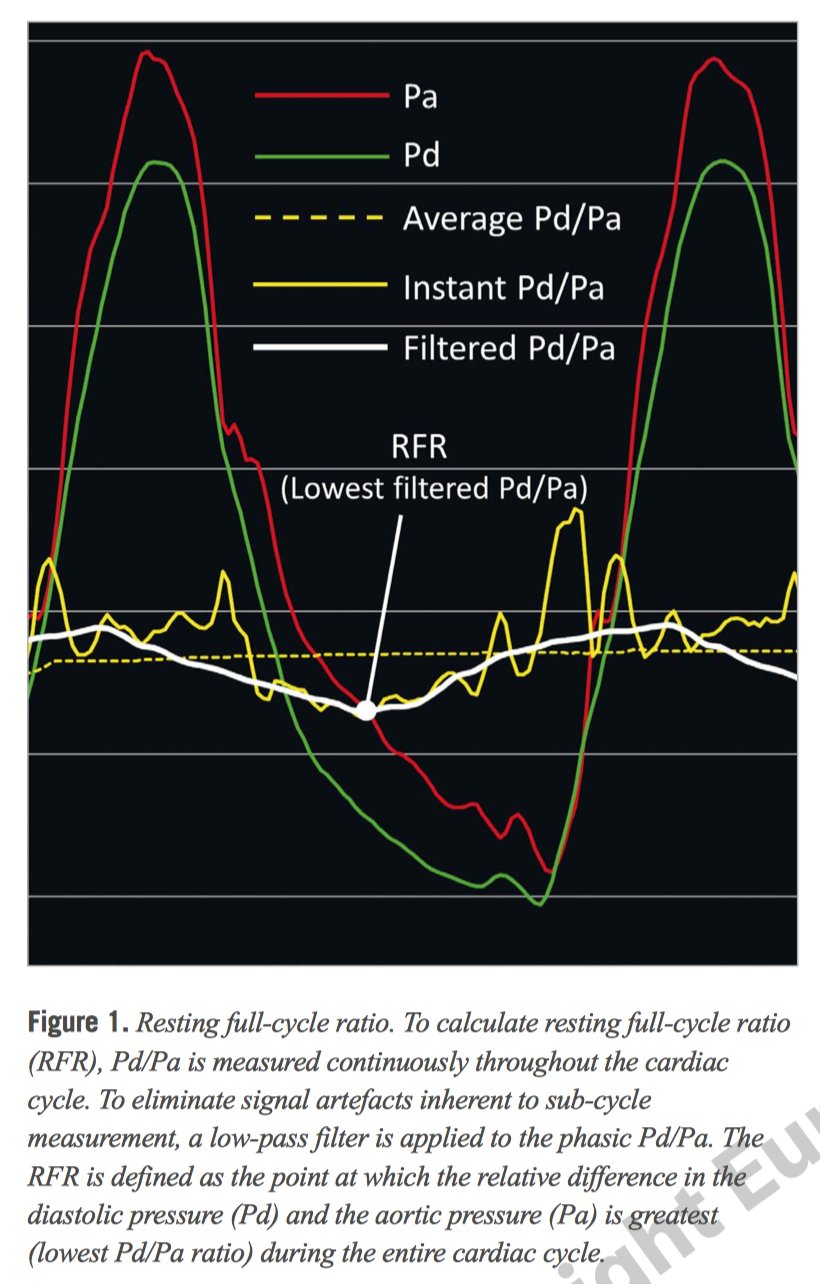 تويتر European Society Of Cardiology Journals على تويتر Validation Of A Novel Non Hyperaemic Index Of Coronary Artery Stenosis Severity The Resting Full Cycle Ratio Validate Rfr Study T Co Wkog3l1mip Sign In Register Required Escardio