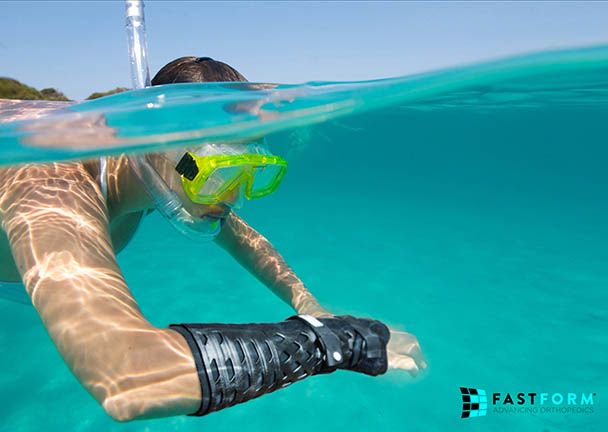 FastFormMed's tweet image. Did you know that Patients can shower and swim as normal when they wear our products, did you know that! buff.ly/2JJGxQn #FastFormMed #Orthopaedics #Waterford