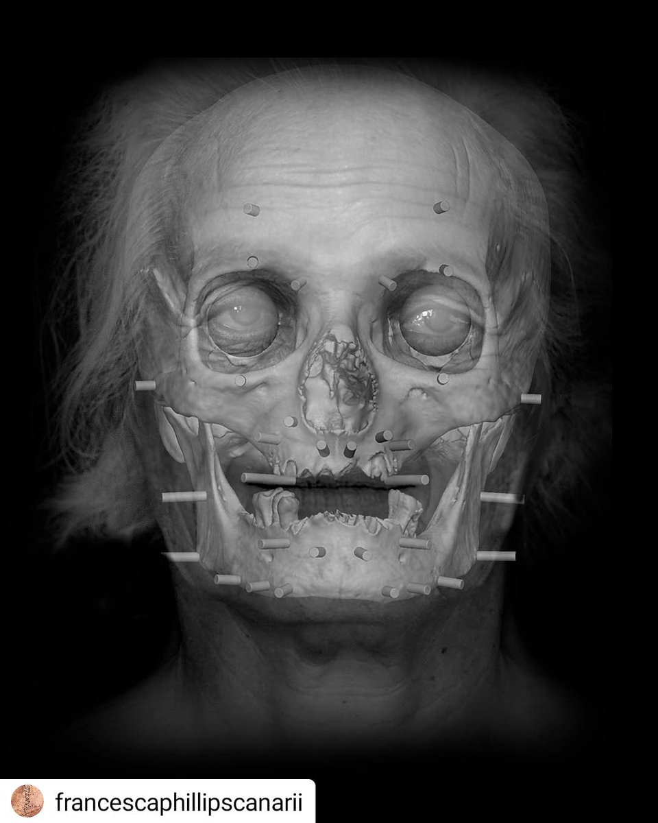 #Repost @francescaphillipscanarii
•  •  •  •  •
Skull n° 1943. A woman emerging. Her remains found in Guayadeque, Gran Canaria. 
@fcphillips @museocanario @wmaiaw  @FaceLabLJMU @directorlsad
*