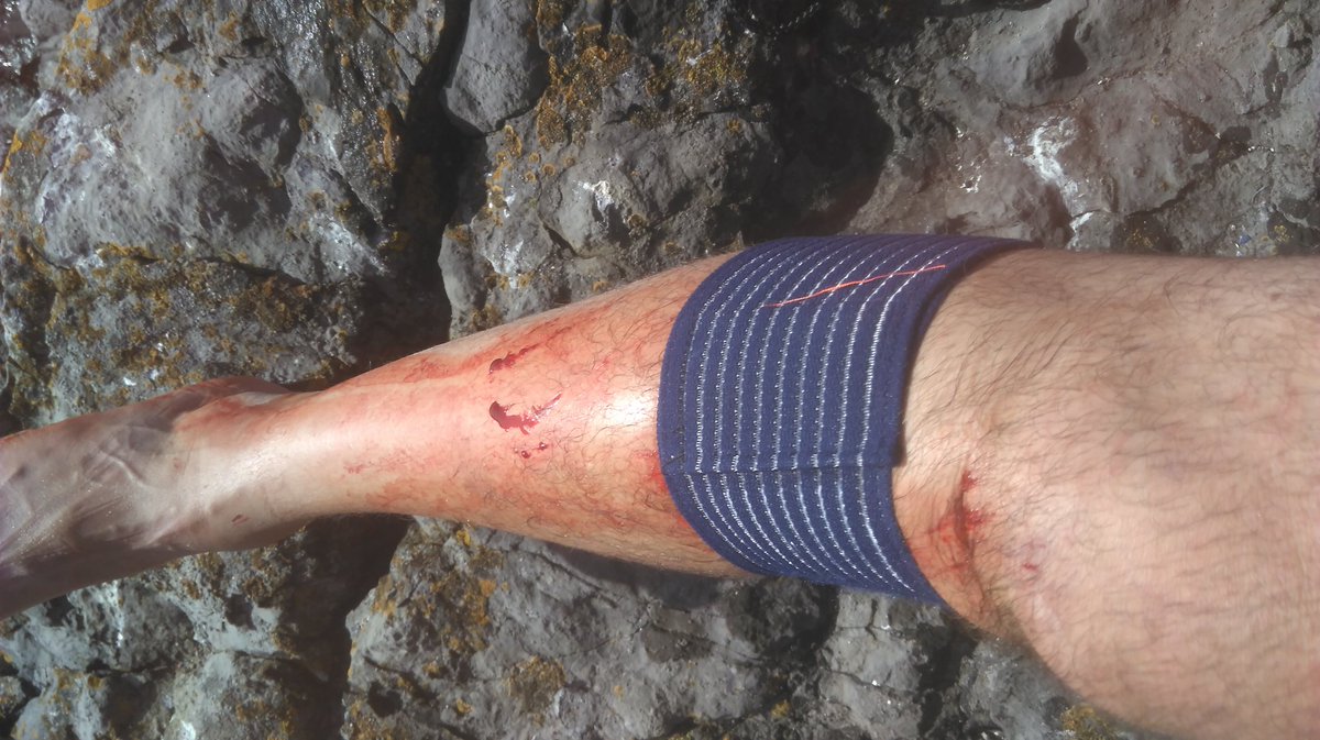 Today's climbing wound