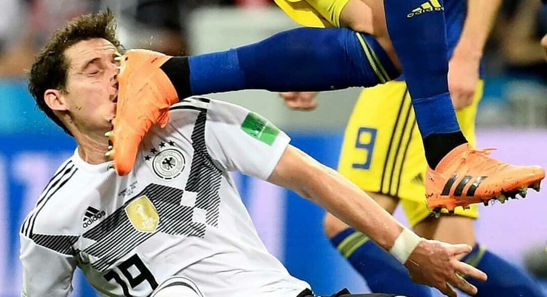 Leon🤫 tweet media