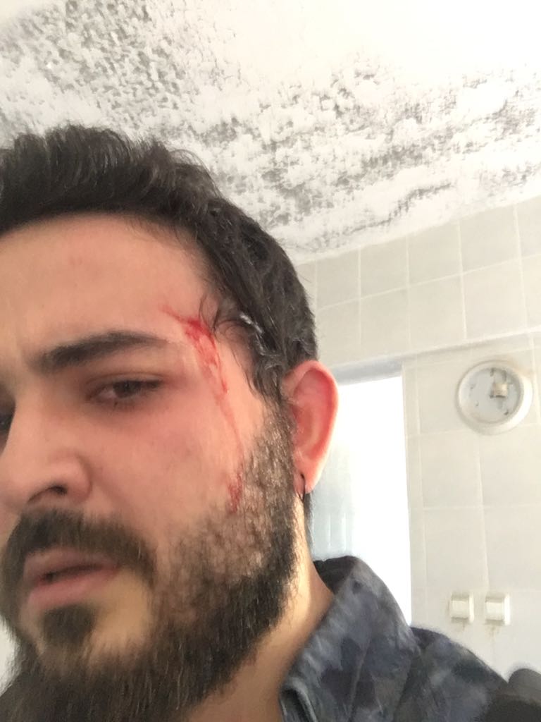 sandıktan kaçtık canımızı zor kurtardık uluhan imamhatip orta okulu darp olan arkadaşlarımız var şuan jandarma karakolunda ifade veriyoruz sonra hastaneden darp raporu alıcaz