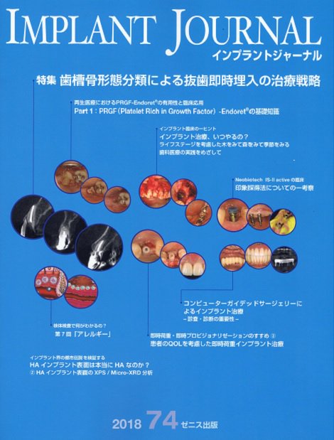 PRGF-Endoret-Japan tweet media