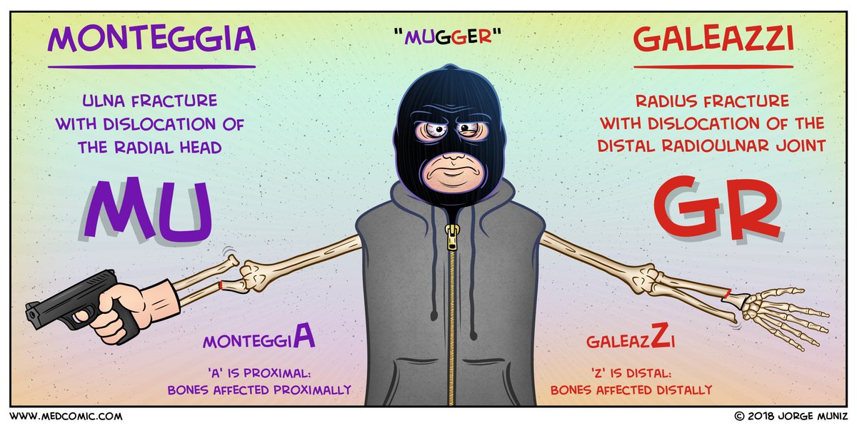 Monteggia vs Galeazzi