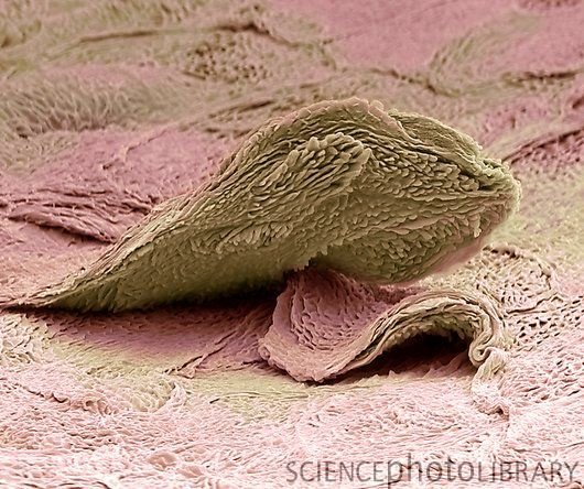 #peau_psyche [VidéoPEAUthèque] n°1
Découvrez une vidéo qui vous montre la PEAU au microscope :  lisse et douce en apparence, la PEAU  présente un relief bien plus tourmenté lorsqu’on la regarde de plus près….
lemonde.fr/sciences/video…