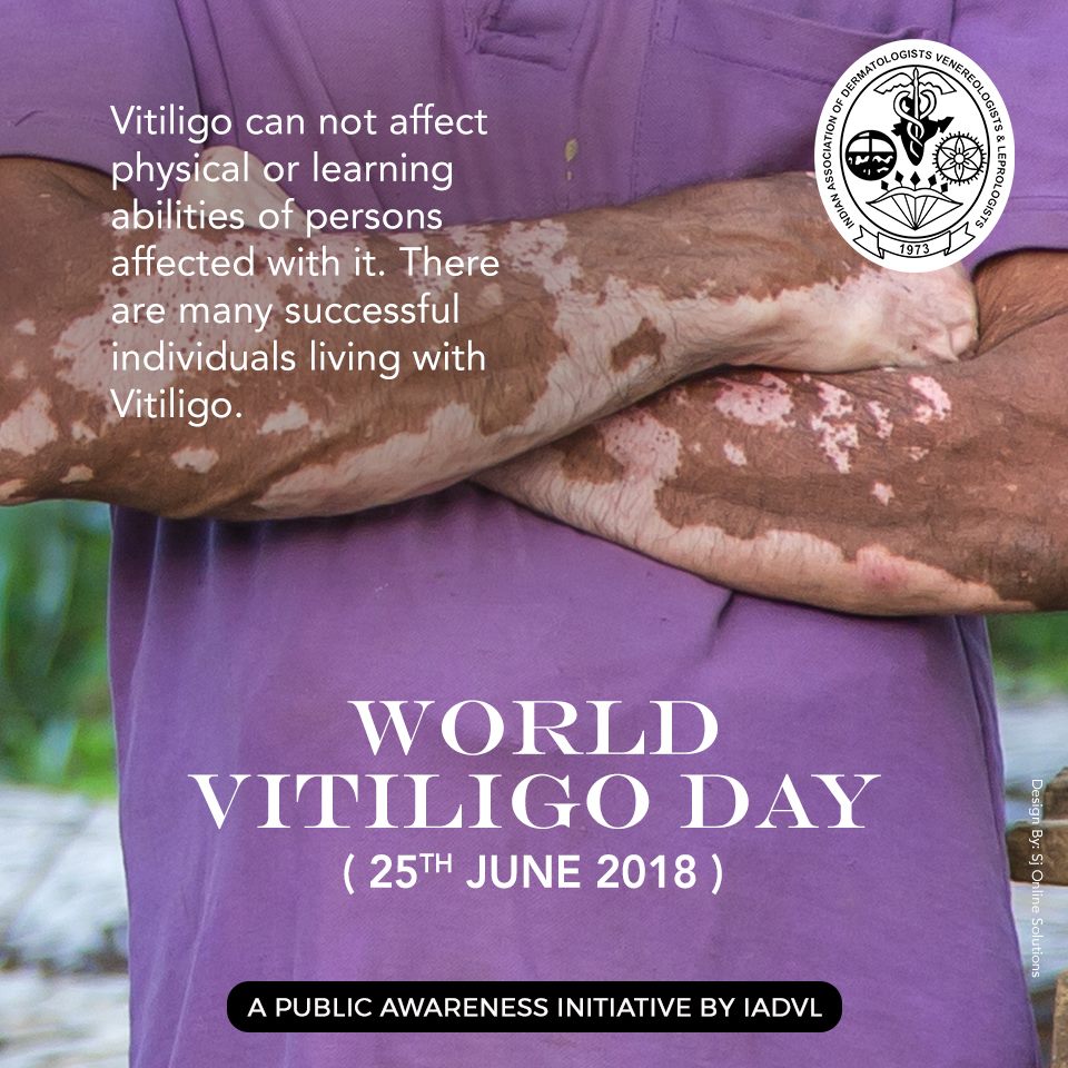 Vitiligo is the skin condition that causes loss of skin color in blotches.

Please don’t self-medicate or use medicines given by your neighborhood chemist, get the right treatment from a qualified dermatologist.

#IADVL #VitiligoDay #June25 #IADVLSkin